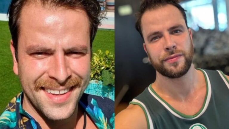 Com menos de uma semana para seu casamento, ex-BBB exibe novo sorriso