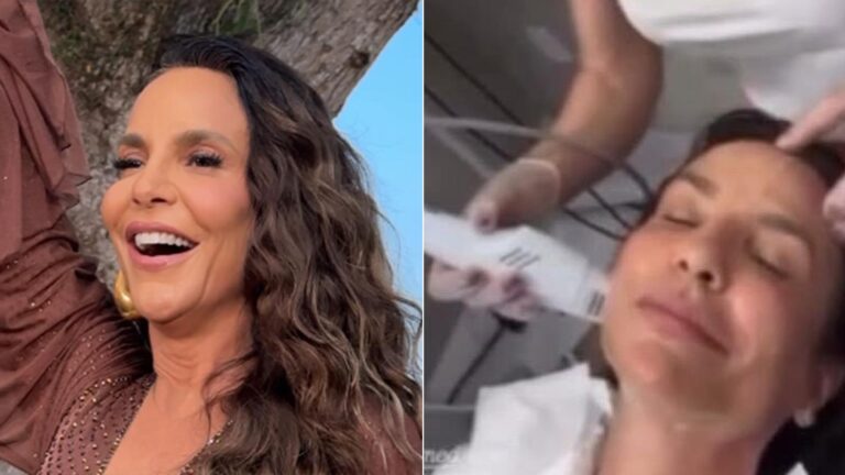 Saiba quanto custa o tratamento coreano que Ivete Sangalo realizou no rosto