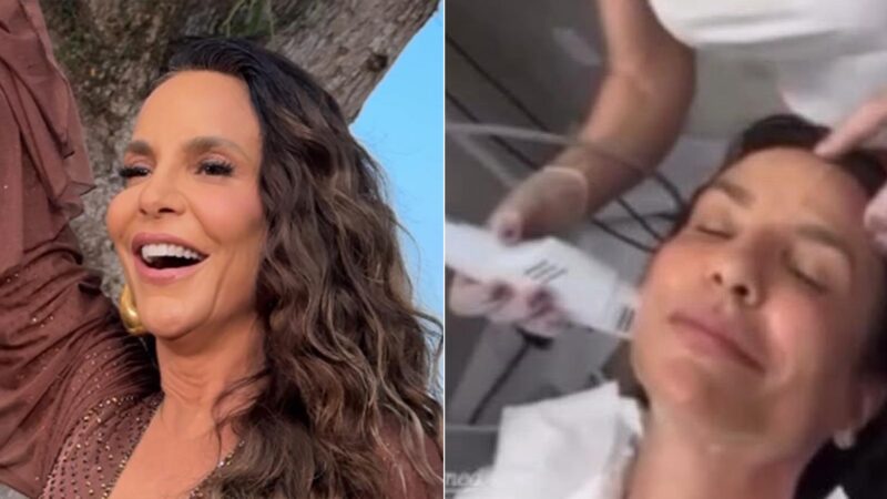 Saiba quanto custa o tratamento coreano que Ivete Sangalo realizou no rosto