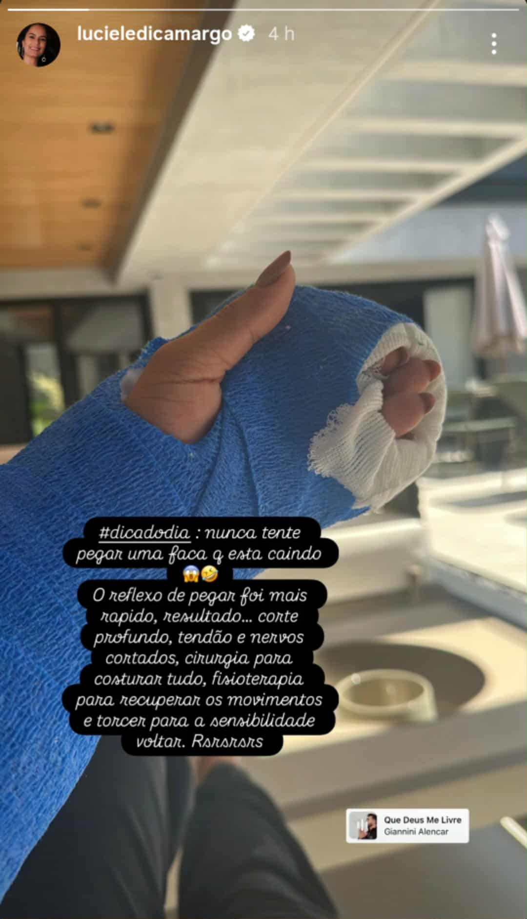 Luciele Di Camargo corta a mão com faca