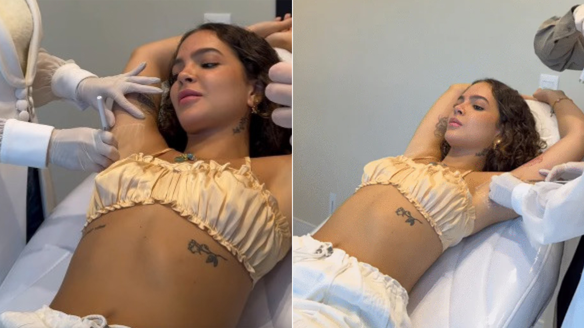 Médica explica motivo de Mel Maia ter feito procedimento nas axilas