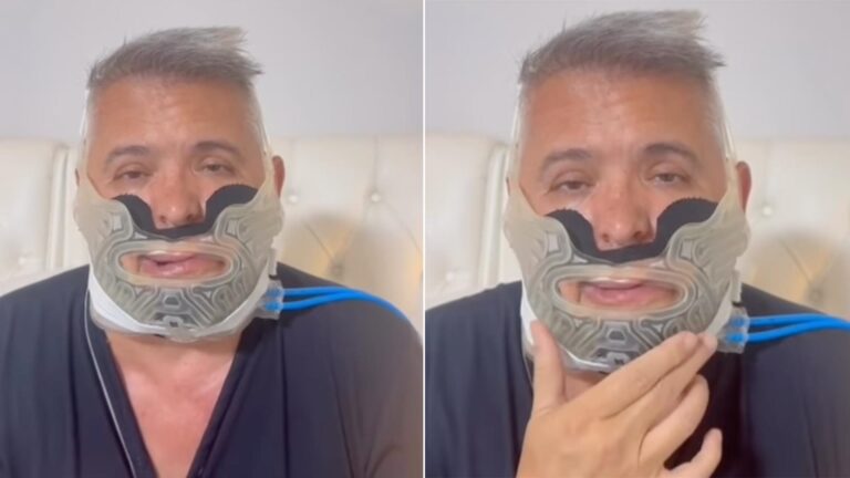 Orlando Morais passa por cirurgia e desabafa: ‘Recuperação difícil’