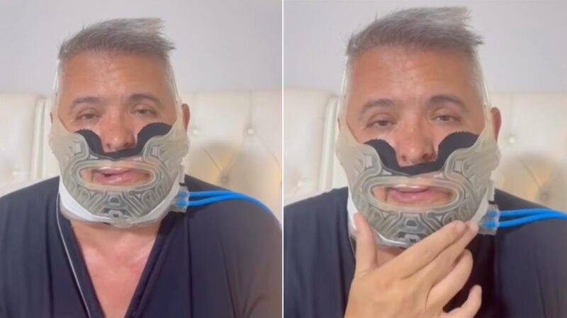 Orlando Morais passa por cirurgia e desabafa: ‘Recuperação difícil’