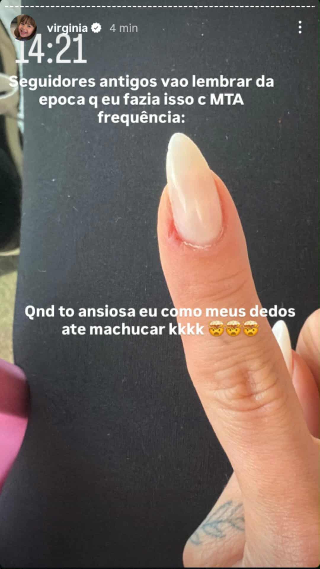 Virginia mostra consequ&ecirc;ncias f&iacute;sicas de sua ansiedade