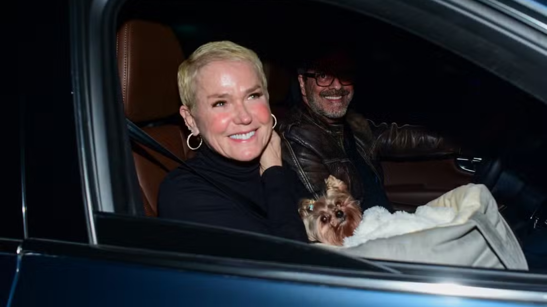 Xuxa Meneghel mostra cabelos mais cheios após transplante capilar: especialista detalha cuidados