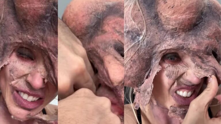Flávia Vianna revela perrengue ao tirar máscara de Halloween e dermatologista faz alerta