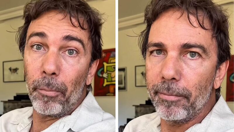 Marcelo Faria revelou o diagnóstico de hérpes-zóster - Foto: Reprodução/Instagram @celofaria