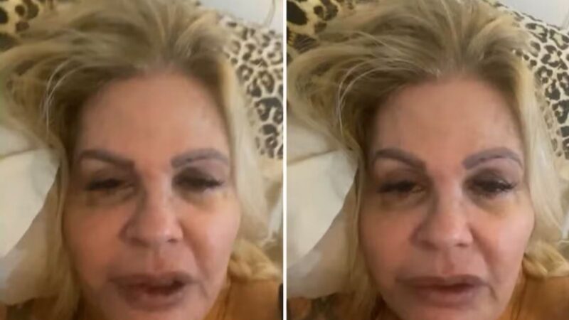 Médico alerta para diagnóstico após desabafo de Monique Evans: ‘No verão e no período chuvoso’
