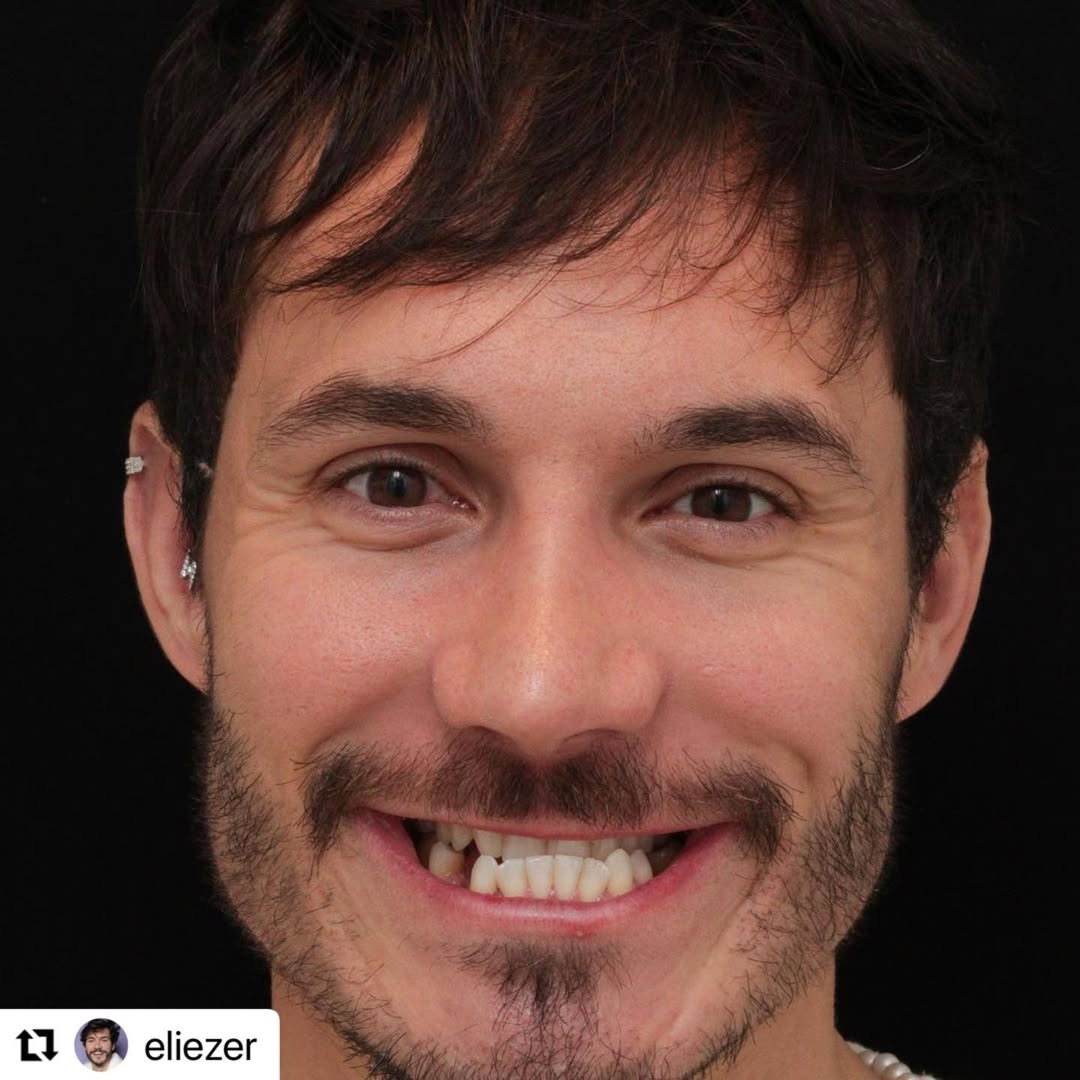 Eliezer — Foto: Reprodução/Instagram@eliezer