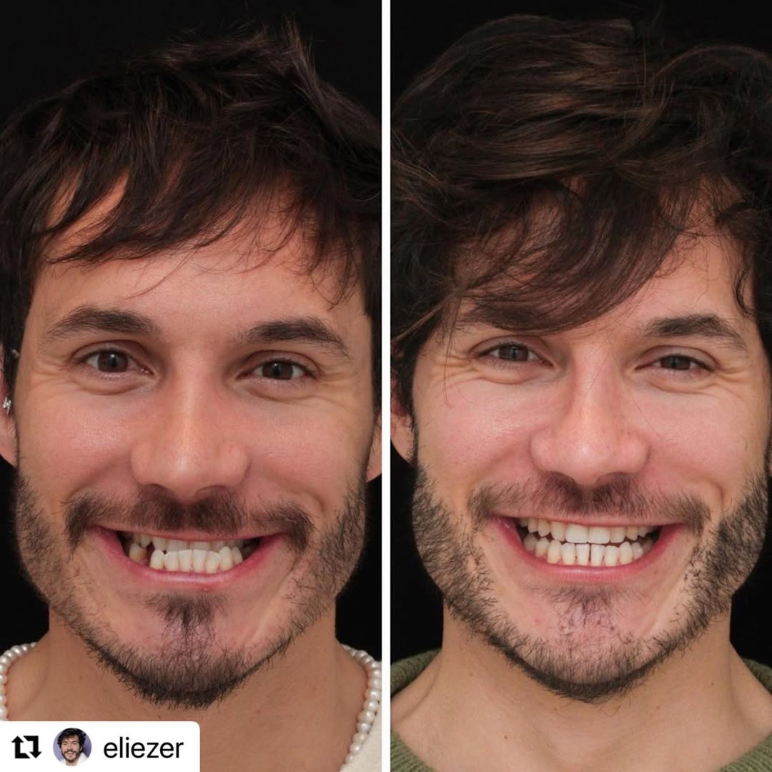 Eliezer — Foto: Reprodução/Instagram@eliezer