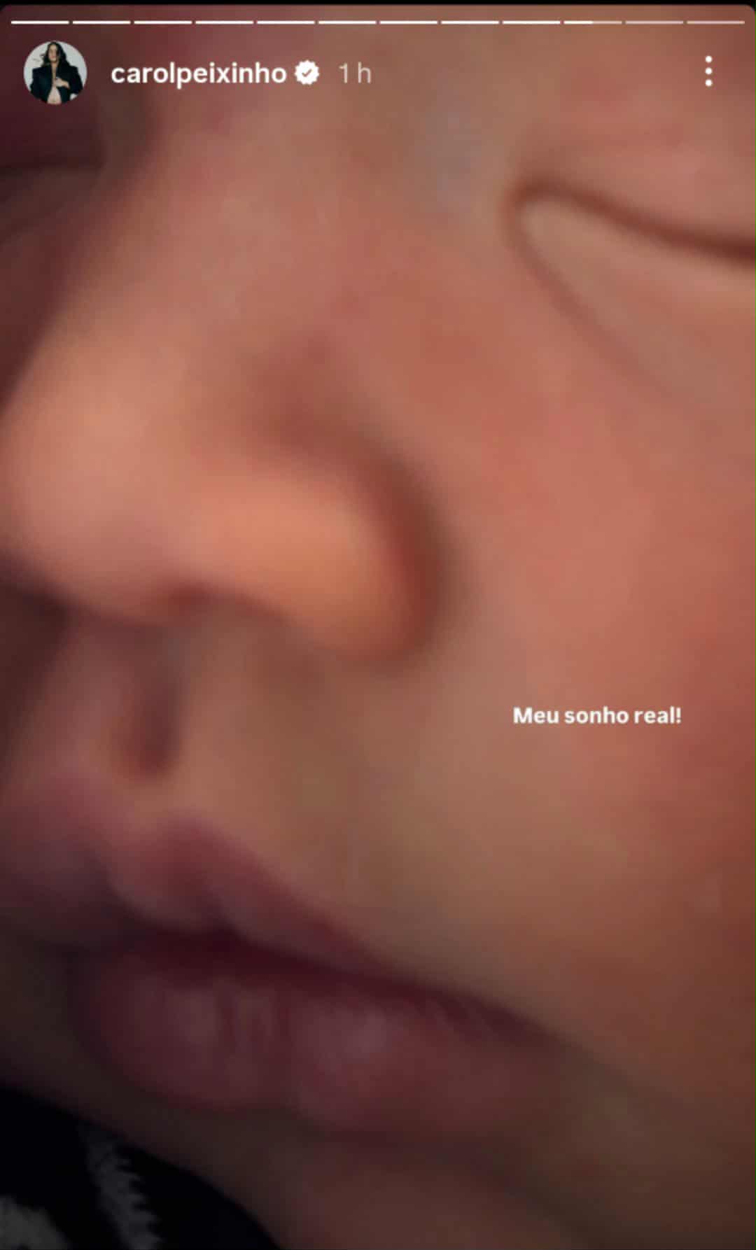 Carol Peixinho mostra o rosto do filho
