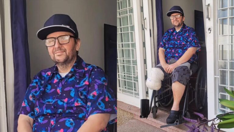 Ex-A Praça É Nossa, humorista amputa o pé após doença agressiva