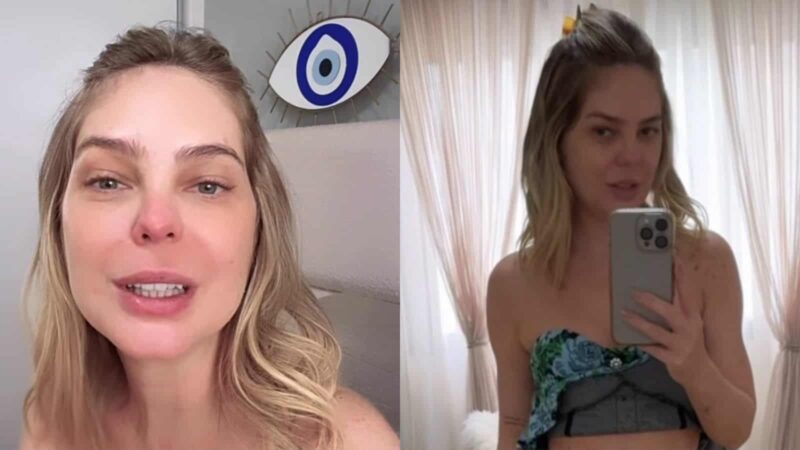 Esposa de Pedro Leonardo mostra resultado de cirurgias