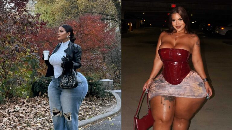 Influenciadora Gracie Bon viraliza por bumbum grande e médica explica: ‘Doença crônica’