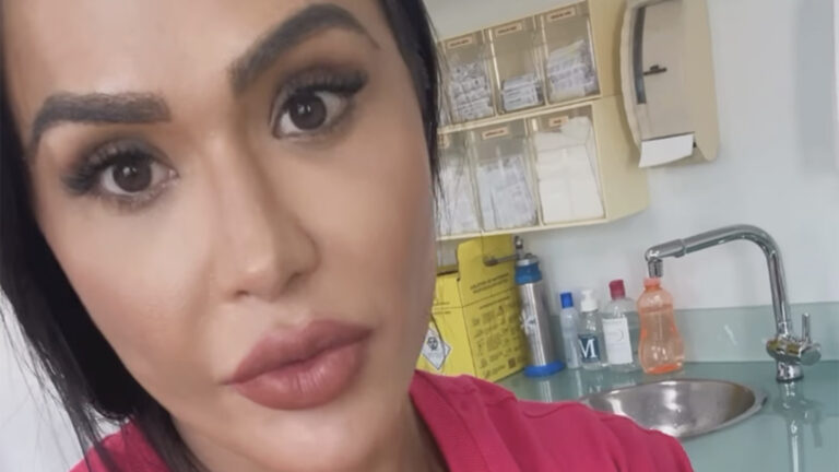 Cicatriz de Gracyanne Barbosa: Musa exibe os detalhes após cirurgia no joelho