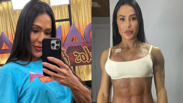 Gracyanne Barbosa mostra antes e depois do corpo e explica mudança: ‘Tomei um susto’