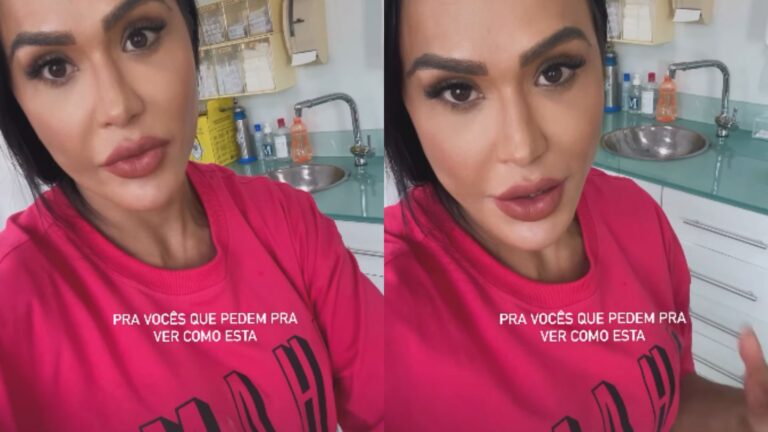 Gracyanne Barbosa revela como está o joelho após a cirurgia