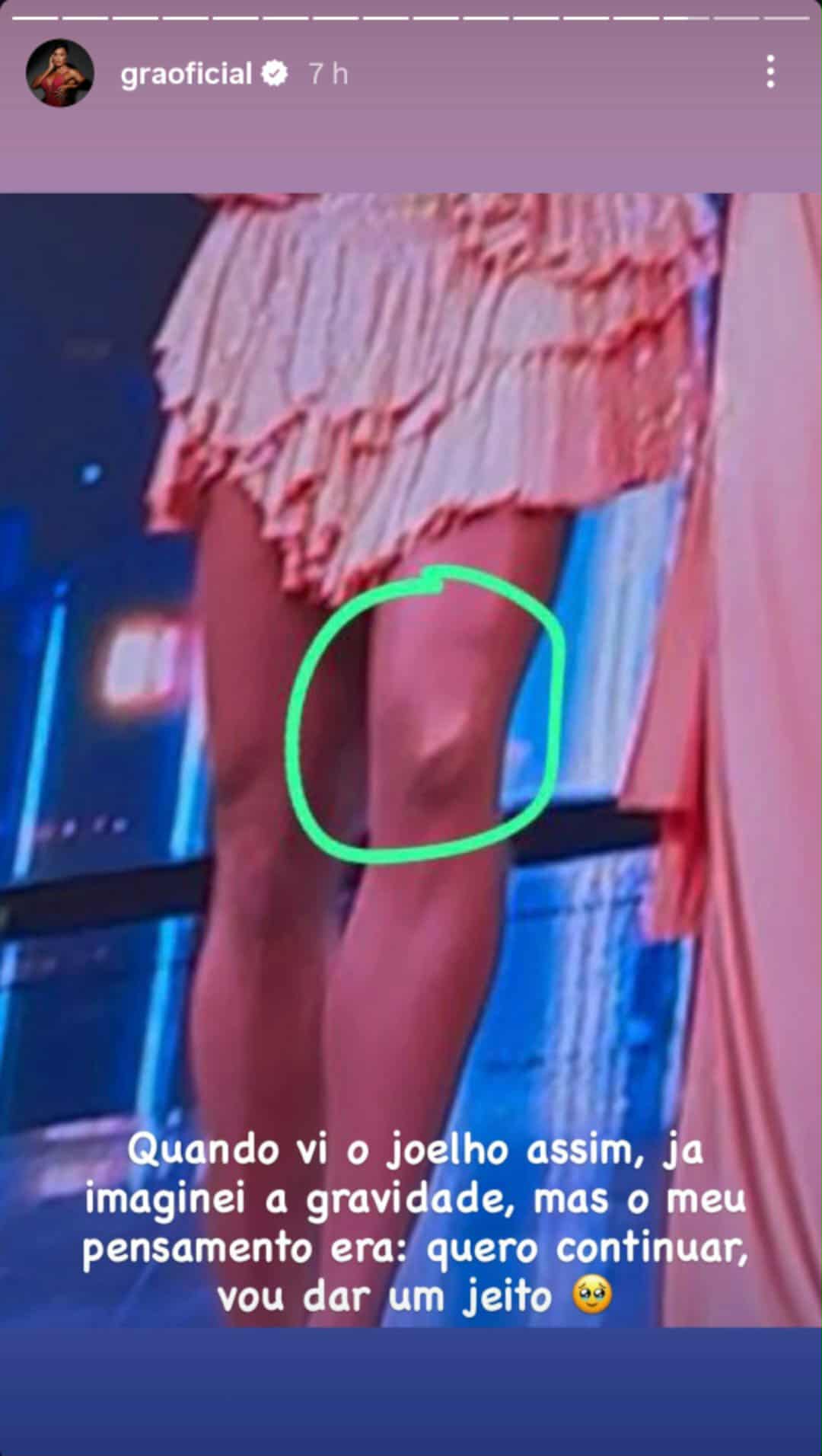 Gracyanne Barbosa mostra como ficou seu joelho após acidente
