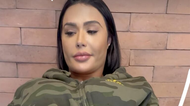 Gracyanne Barbosa exibe machucado no quadril após assalto à mão armada