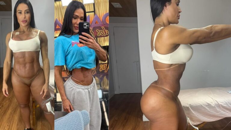 Gracyanne Barbosa e o ganho de peso após cirurgia: especialista explica o que pode ter acontecido