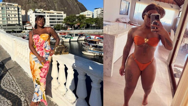 Jojo Todynho elimina mais de 80 kg e médico avalia cirurgia: ‘Preparo nutricional’