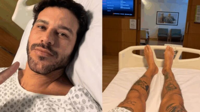 Médico explica cirurgia de ex-BBB Rodrigo Mussi para corrigir sequela; entenda
