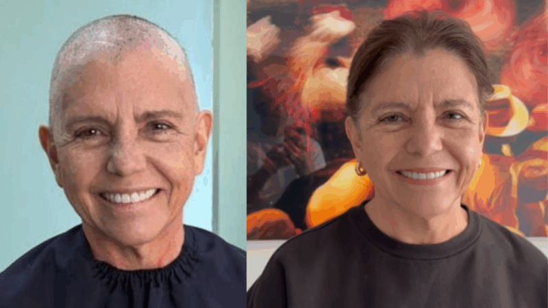 Roseana Sarney compartilha batalha contra o câncer e especialista reforça: ‘Individualização do tratamento’