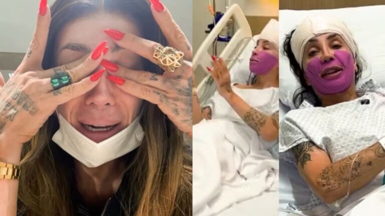 Maya Massafera passa por cirurgia e médica alerta: ‘Nem todos os rostos’
