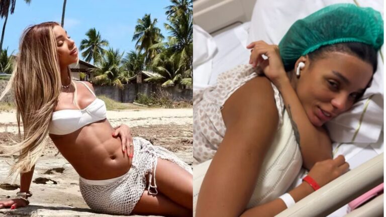 Especialista aponta riscos da cirurgia de Brunna Gonçalves: ‘Trombose’