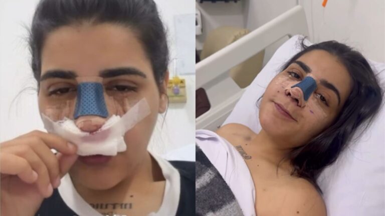Yasmin Santos passa por cirurgia após emagrecer 62kg e médica alerta: ‘Muda bastante’
