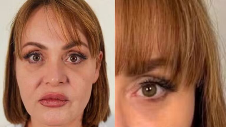 Eterna Usurpadora, Gaby Spanic exibe resultado de rejuvenescimento facial; compare antes e depois
