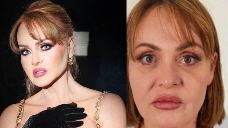 Antes e depois de Gaby Spanic chama atenção e médico aponta: ‘A procura cresceu’