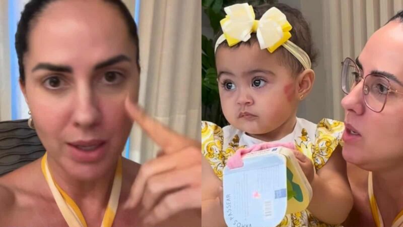 Graciele Lacerda explica mancha no rosto da filha: ‘Reação’