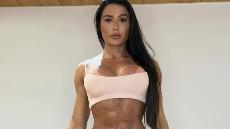 Gracyanne Barbosa ganha 20 kg em apenas três dias; médica explica o motivo: ‘O corpo se reorganiza’