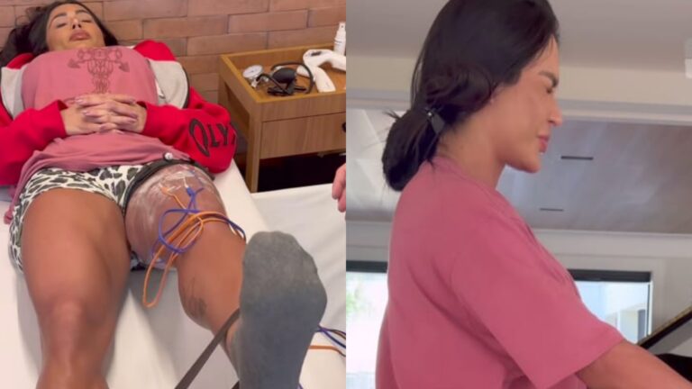 Gracyanne Barbosa mostra evolução na fisioterapia após lesão: ‘Rumo à recuperação’