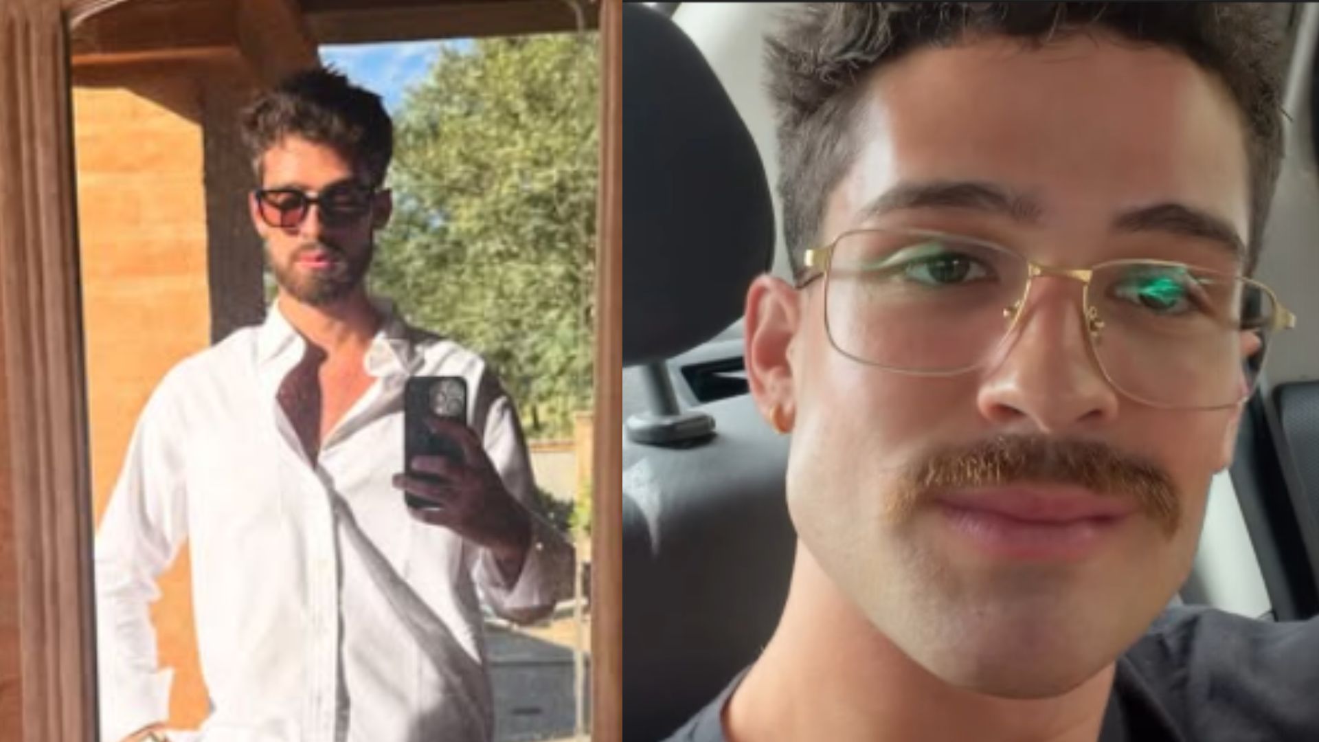João Guilherme antes e depois - Fotos: Reprodução/Instagram