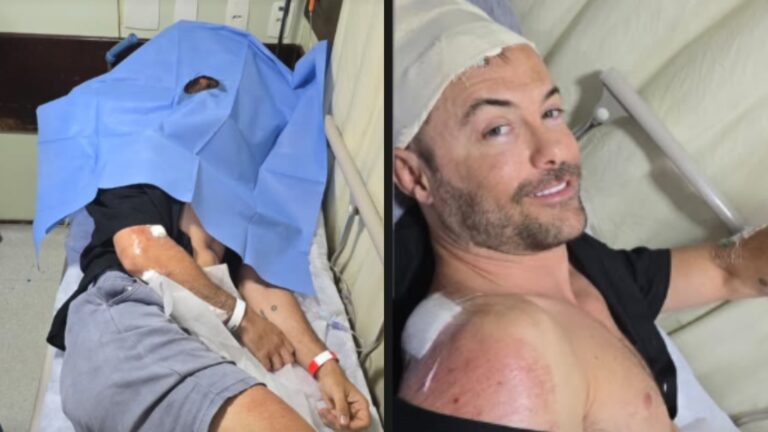Acidente de Kayky Brito liga sinal vermelho e médico explica risco extremo: ‘Consequências’