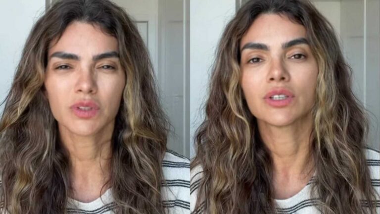 Médico alerta para diagnóstico após caso de Kelly Key: ‘Atendimento médico com urgência’