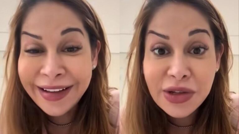 Maíra Cardi fica ‘torta’ após botox e médico explica caso: ‘Individual’