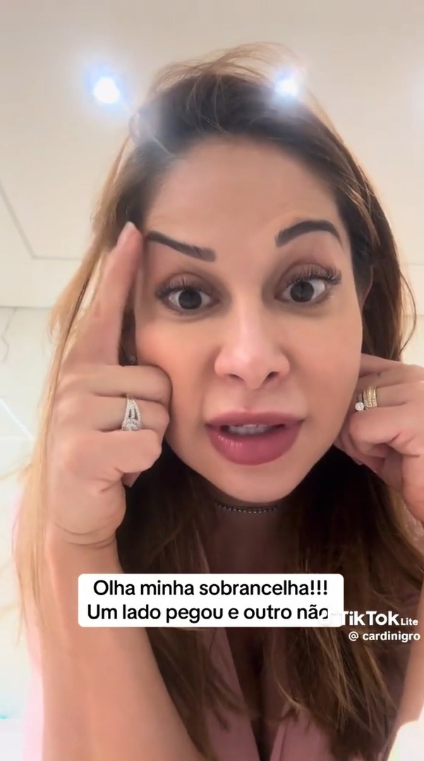Maíra Cardi revela que procedimento estético deu errado - Reprodução/TikTok @cardinigro 