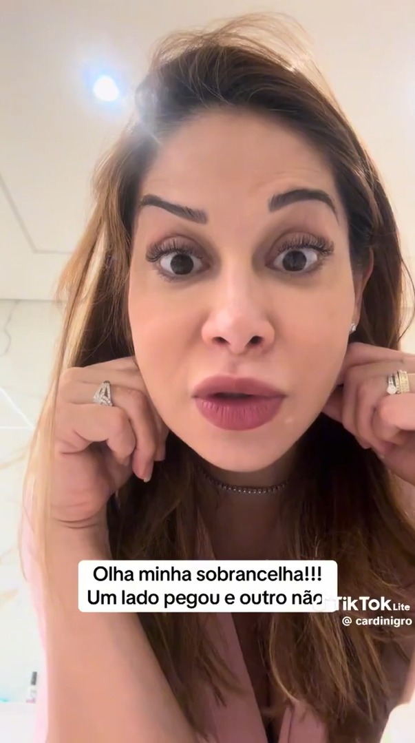 Maíra Cardi revela que procedimento estético deu errado - Reprodução/TikTok @cardinigro 