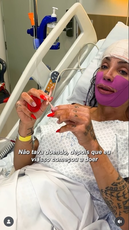 Maya Massafera retira ossos do maxilar - Reprodução/Instagram @mayamassafera 