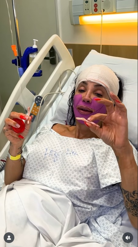 Maya Massafera retira ossos do maxilar - Reprodução/Instagram @mayamassafera 