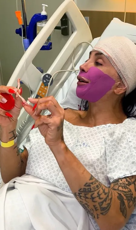Maya Massafera retira ossos do maxilar - Reprodução/Instagram @mayamassafera 