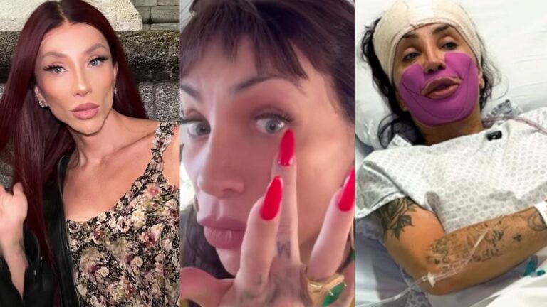 Nova cor dos olhos, remoção de ossos e mais: Relembre as cirurgias de Maya Massafera