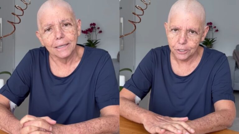 Roseana Sarney relata efeito colateral de tratamento contra o câncer: ‘Nunca imaginei’