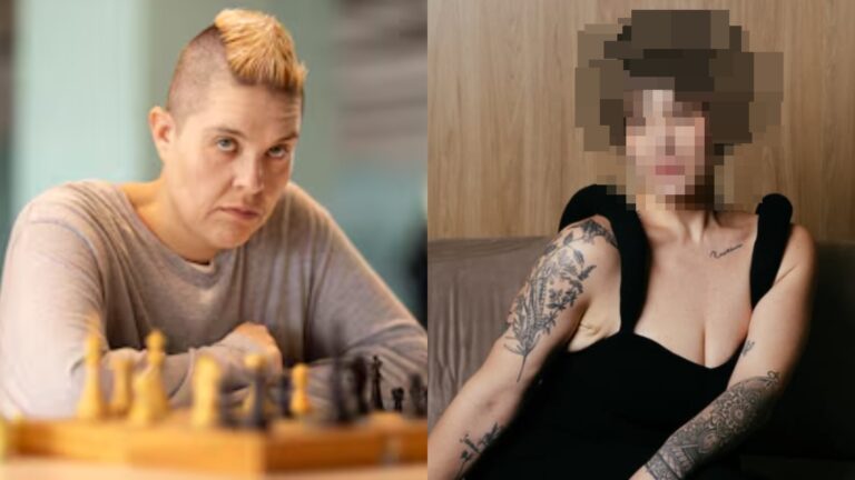 Atriz de Tremembé muda o visual e médica explica impacto no couro cabeludo: ‘Totalmente exposto’