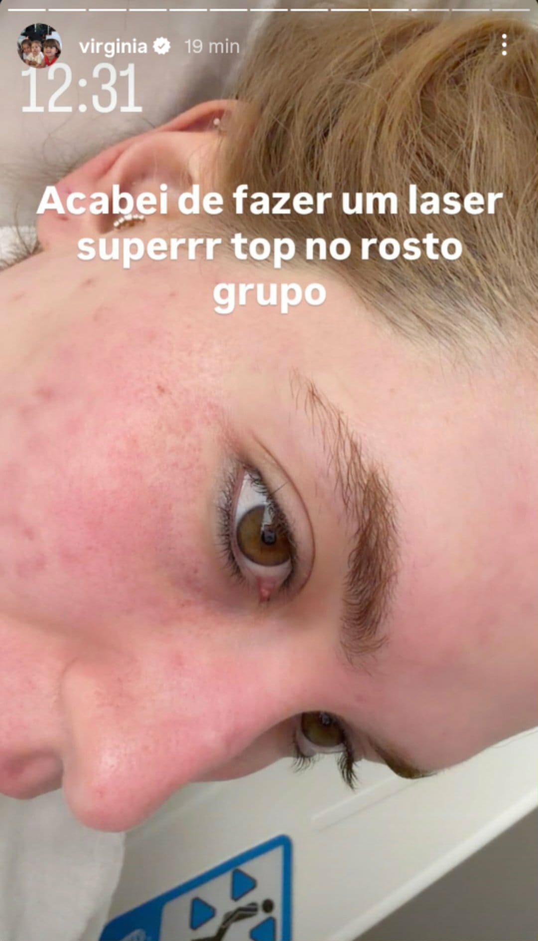 Virginia faz laser