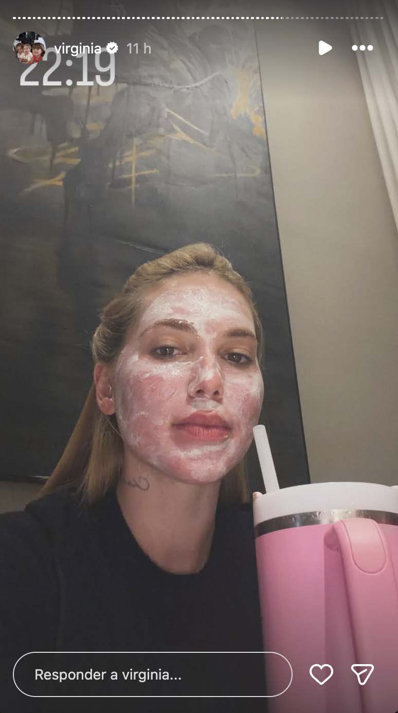 Virginia mostra sua aparência após passar por tratamento com laser - Foto: Reprodução / Instagram