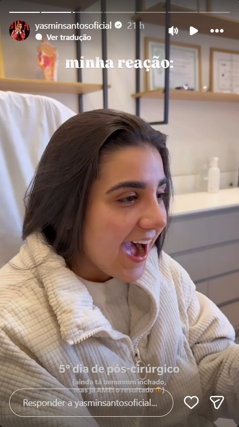 Yasmin Santos mostra resultado da rinoplastia - Reprodução/Instagram @yasminsantosoficial 